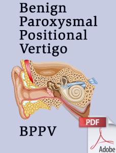 BPPV (Benign Paroxysmal Positional Vertigo) Brochure