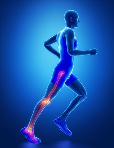 Inflammation Joints Tendons